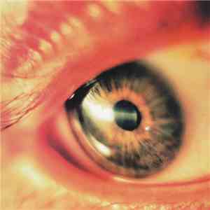 Timeblind - Rugged Redemption download free